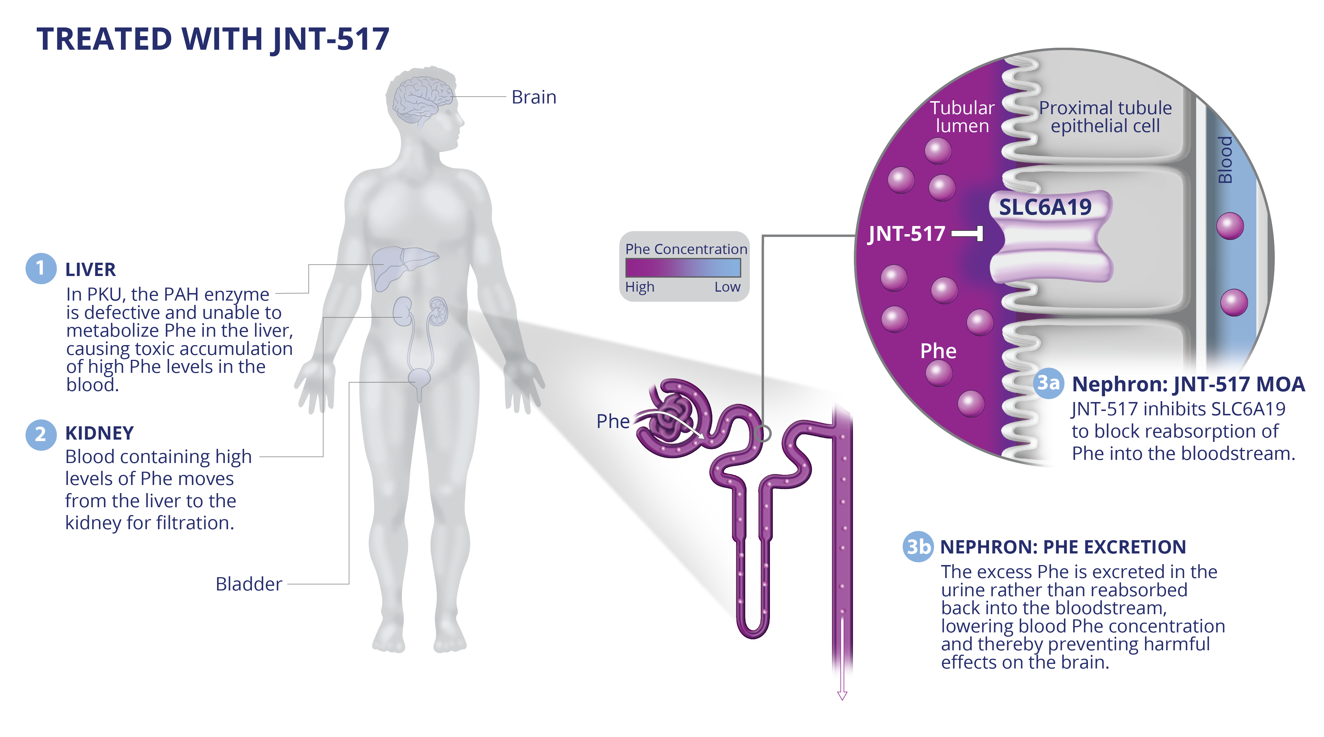 JNT-517 inhibits SLC6A19 to block reabsorption of Phe into the bloodstream. The excess Phe is instead excreted in the urine.