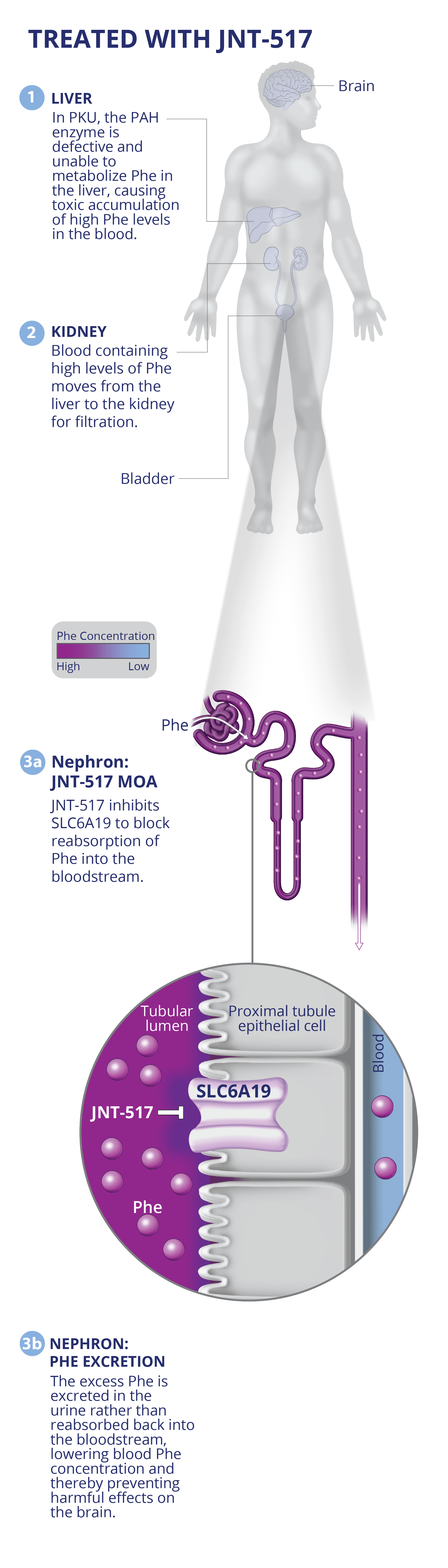 JNT-517 inhibits SLC6A19 to block reabsorption of Phe into the bloodstream. The excess Phe is instead excreted in the urine.